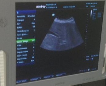 liver