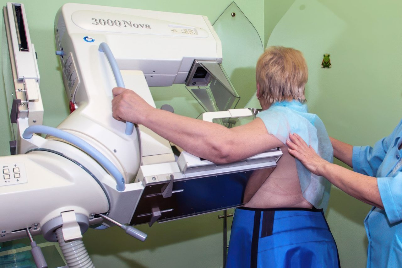 Цифровая маммография